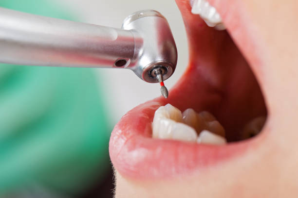 Best Orthodontic Emergency Dentist in Grove Hill, AL